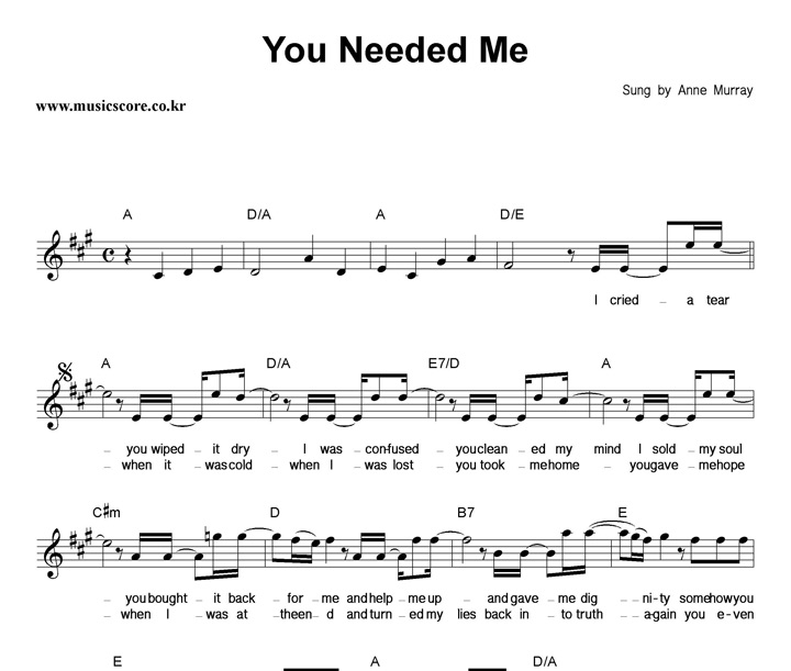 Anne Murray You Needed Me Ǻ