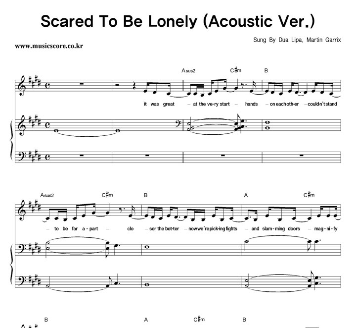Dua Lipa,Martin Garrix Scared To Be Lonely (Acoustic Ver.) ǾƳ Ǻ