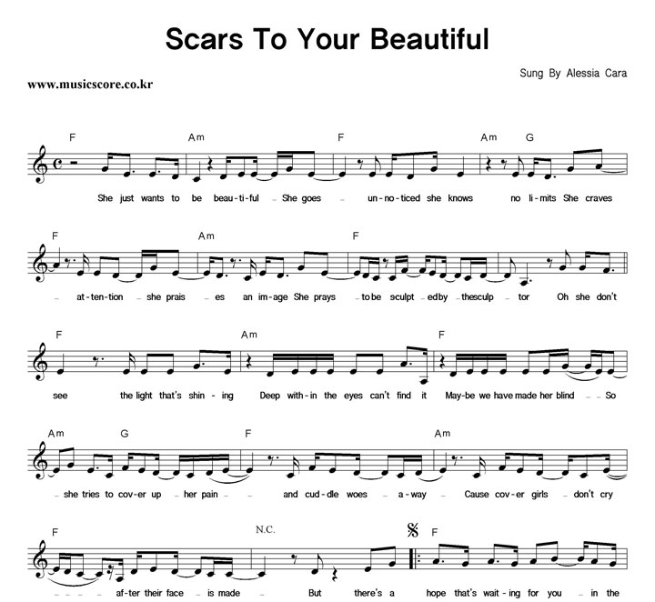 Alessia Cara Scars To Your Beautiful Ǻ