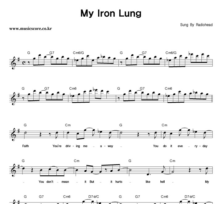 Radiohead My Iron Lung Ǻ